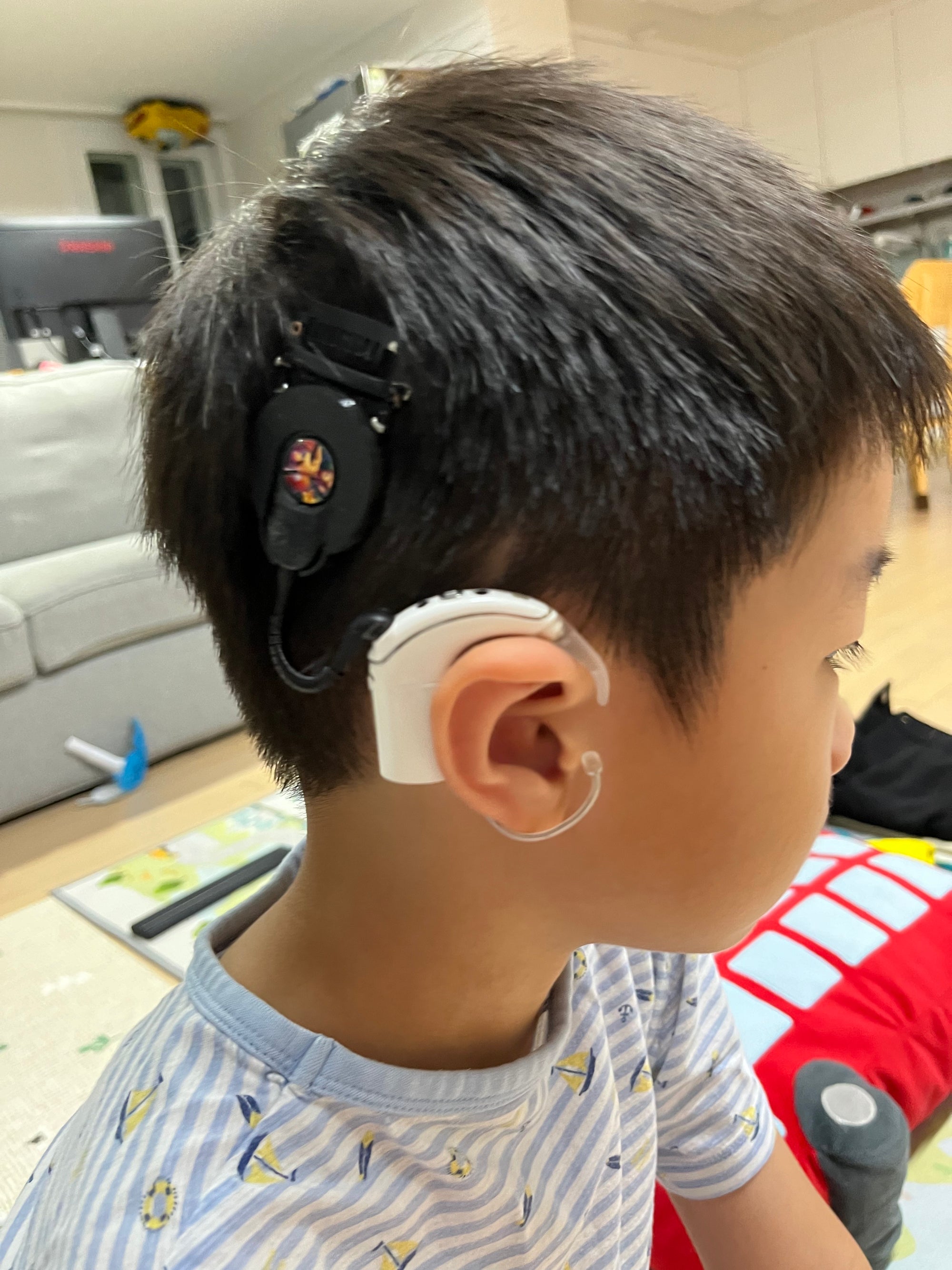 Cochlear Implant coil case for N7 and N8
